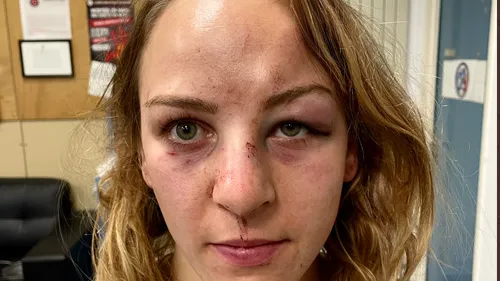 « Que manquait-il ? La mort au bout, peut-être ? » : la judoka...